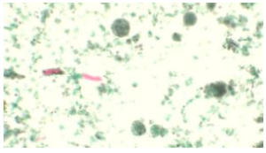 Lâmina preparada com protozoários Entamoeba Coli (trofozoítos)