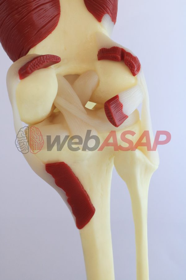 Articulação do Joelho com Músculos - Image 3