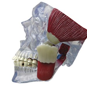 Articulação Temporomandibular