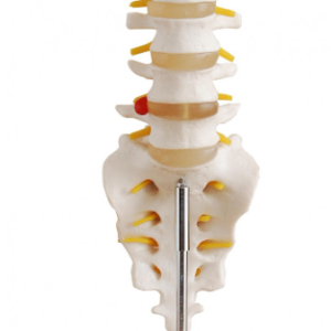 Coluna Vertebral Lombar